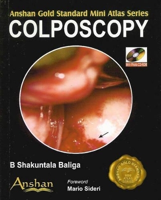 Mini Atlas of Colposcopy - B. Shakuntala Baliga