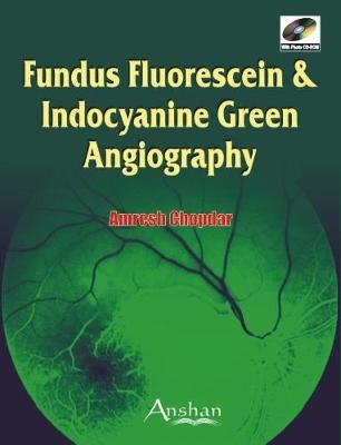 Fundus Fluorescein and Indocyanine Green Angiography - Amresh Chopdar