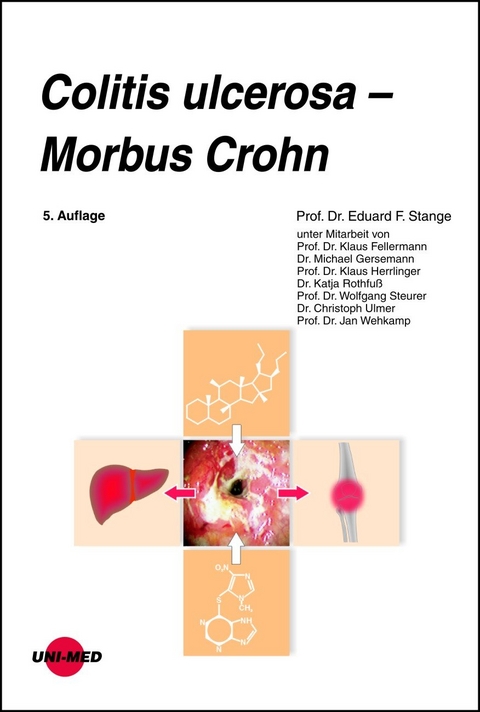 Colitis ulcerosa - Morbus Crohn - Eduard F. Stange