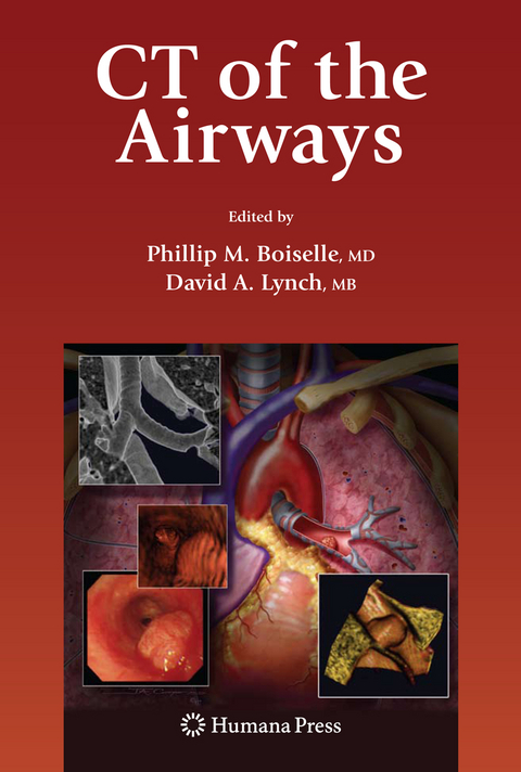 CT of the Airways - 