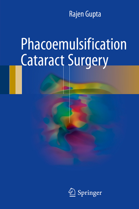 Phacoemulsification Cataract Surgery -  Rajen Gupta