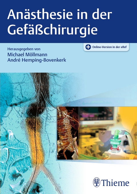 Anästhesie in der Gefäßchirurgie - 