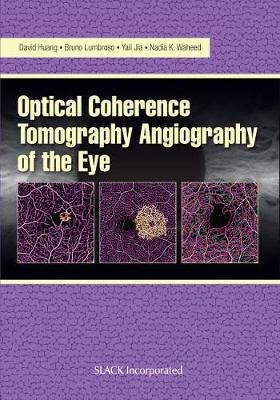 Optical Coherencre Tomography Angiography of the Eye - 