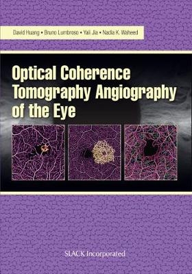 Optical Coherence Tomography Angiography of the Eye - 