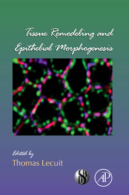 Tissue Remodeling and Epithelial Morphogenesis - 