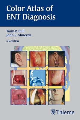 Color Atlas of ENT Diagnosis - Tony R. Bull, John S. Almeyda