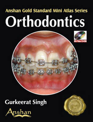 Mini Atlas of Orthodontics - Gurkeerat Singh