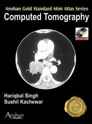 Mini Atlas of Computed Tomography - Hariqbal Singh, Sushil Kachewar, D. Karthikeyan