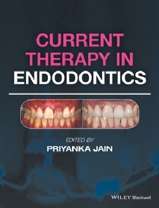 Current Therapy in Endodontics - 