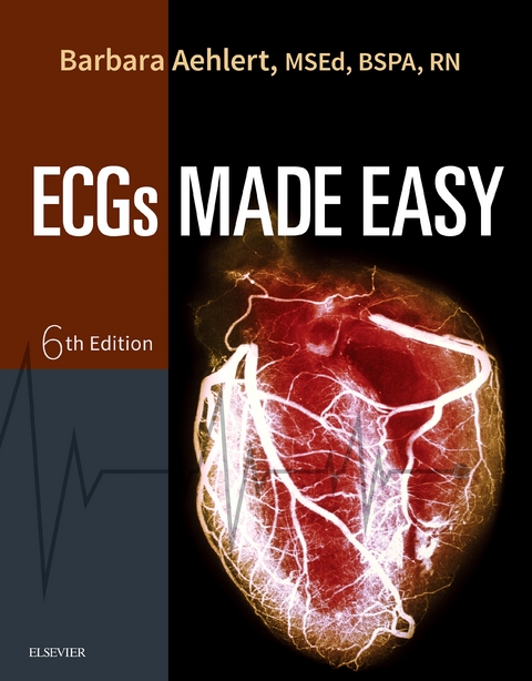 Pocket Guide for ECGs Made Easy - E-Book -  Barbara J Aehlert