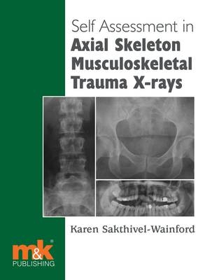 Self-assessment in Axial Skeleton Musculoskeletal Trauma X-rays - Karen Sakthivel-Wainford