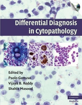 Differential Diagnosis in Cytopathology with CD-ROM - 