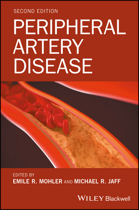 Peripheral Artery Disease - 