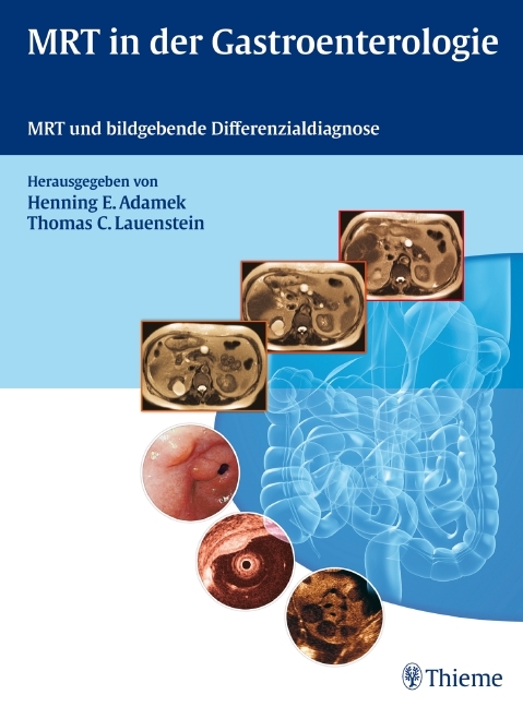 MRT in der Gastroenterologie - 