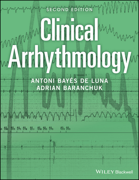 Clinical Arrhythmology -  Adrian Baranchuk,  Antoni Bay s de Luna