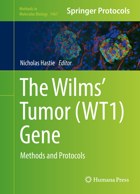 The Wilms' Tumor (WT1) Gene - 