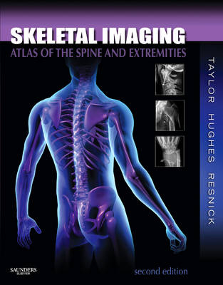 Skeletal Imaging - John A. M. Taylor, Tudor H. Hughes, Donald L. Resnick