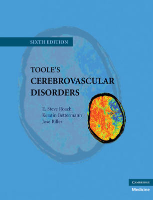 Toole's Cerebrovascular Disorders - E. Steve Roach, Kerstin Bettermann, Jose Biller