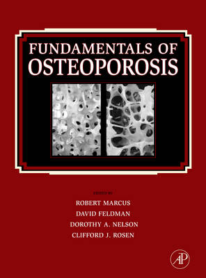 Fundamentals of Osteoporosis - 