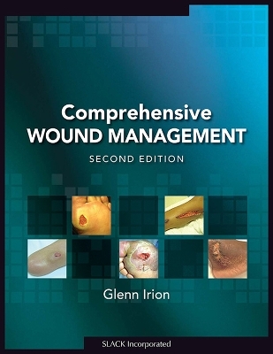 Comprehensive Wound Management - Glenn Irion