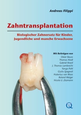 Zahntransplantation - Andreas Filippi