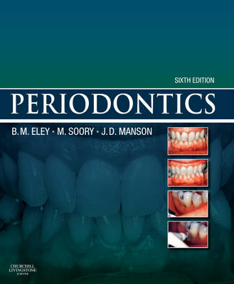 Periodontics - Barry M. Eley, Mena Soory, J. D. Manson