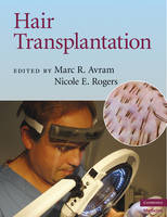 Hair Transplantation - Marc R. Avram, Nicole E. Rogers
