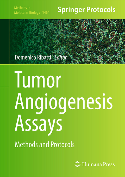 Tumor Angiogenesis Assays - 