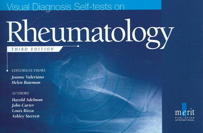 Visual Diagnosis Self-Tests on Rheumatology - Paul Emery