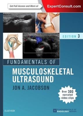 Fundamentals of Musculoskeletal Ultrasound E-Book -  Jon A. Jacobson