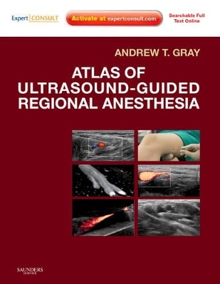 Atlas of Ultrasound-guided Regional Anesthesia - Andrew T. Gray