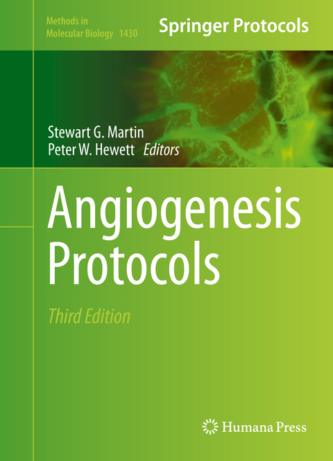 Angiogenesis Protocols - 