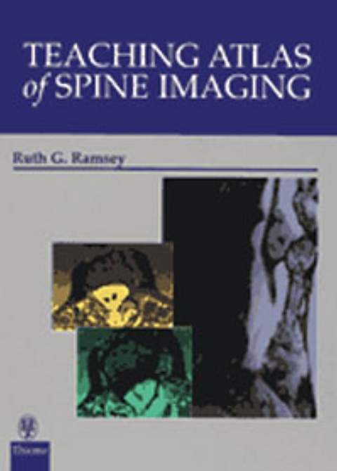 Teaching Atlas of Spine Imaging - Ruth G. Ramsey