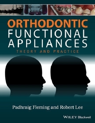 Orthodontic Functional Appliances - 