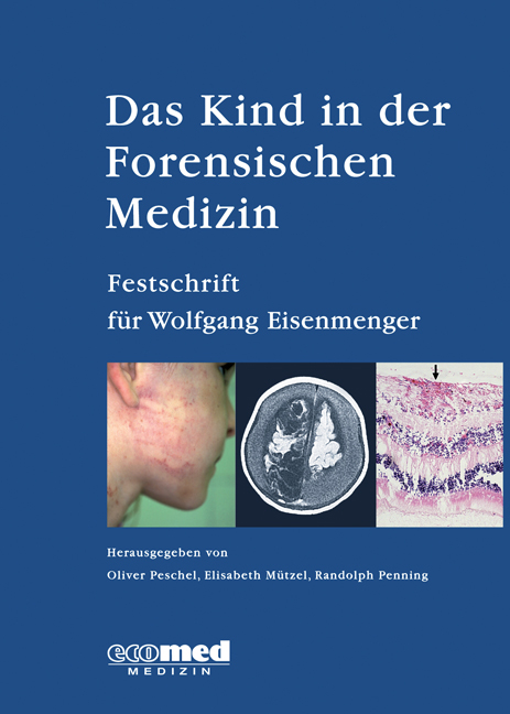 Das Kind in der Forensischen Medizin - Oliver Peschel, Elisabeth Mützel, Randolph Penning
