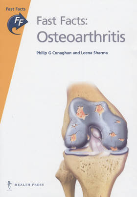Fast Facts: Osteoarthritis and Gout - Philip Conaghan, Leena Sharma