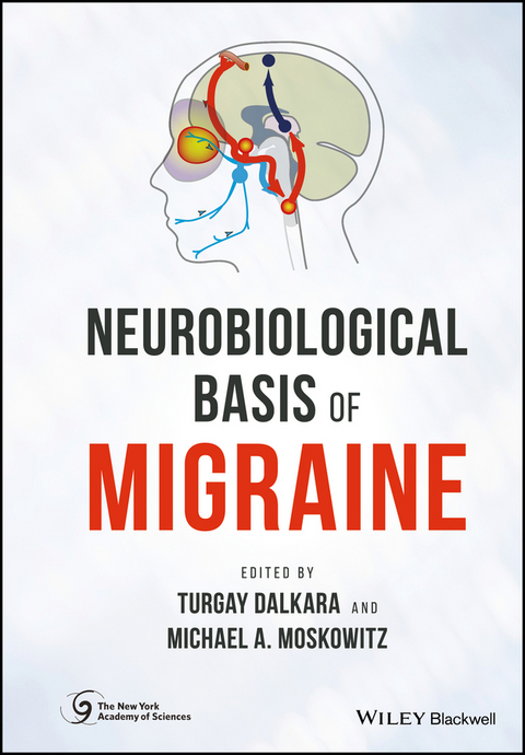 Neurobiological Basis of Migraine - 