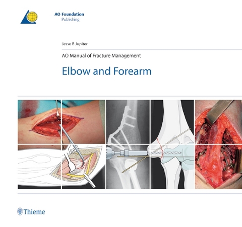 AO Manual of Fracture Management - Elbow & Forearm - Jesse Jupiter