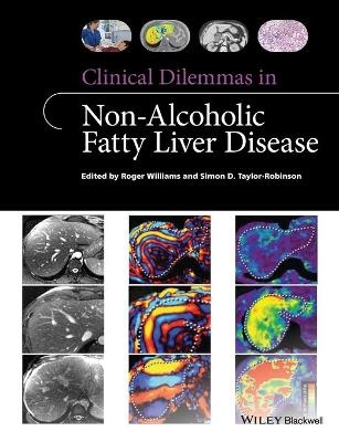 Clinical Dilemmas in Non-Alcoholic Fatty Liver Disease - Roger Williams, Simon D. Taylor-Robinson
