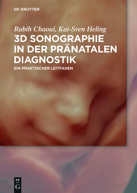 3D-Sonografie in der pränatalen Diagnostik - Rabih Chaoui, Kai-Sven Heling