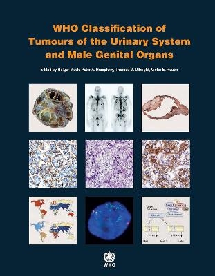 WHO classification of tumours of the urinary system and male genital organs -  International Agency for Research on Cancer