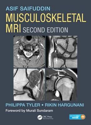 Musculoskeletal MRI -  Rikin Hargunani,  Asif Saifuddin,  Philippa Tyler