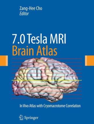 7.0 TeslaMRI Brain Atlas - 
