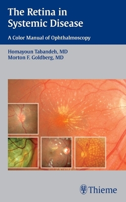 The Retina in Systemic Disease - Homayoun Tabandeh, Morton F. Goldberg