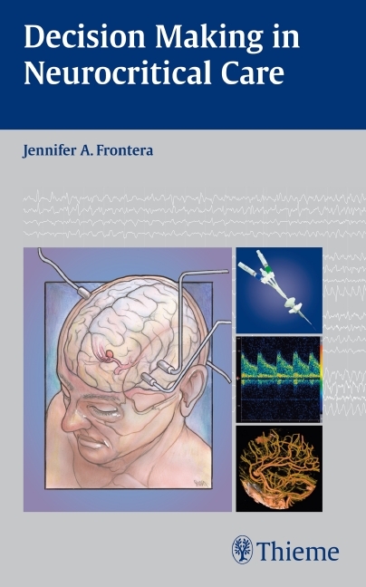 Decision Making in Neurocritical Care - 