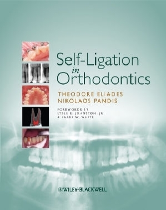 Self-Ligation in Orthodontics - Theodore Eliades, Nikolaos Pandis