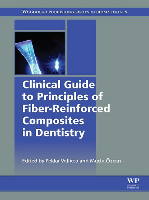 Clinical Guide to Principles of Fiber-Reinforced Composites in Dentistry - 