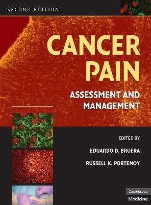 Cancer Pain - 