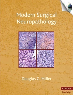 Modern Surgical Neuropathology with CD-ROM - Douglas C. Miller