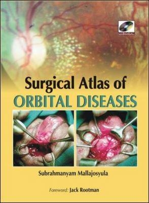 Surgical Atlas of Orbital Diseases - Subrahmanyam Mallajosyula